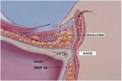 醫(yī)美激光培訓(xùn)班