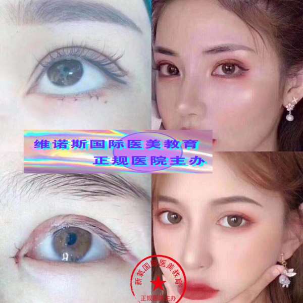 维诺斯医学美容学校微整形培训中心,想学习玻尿酸,美白针,肉毒素,人胎